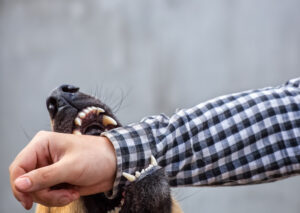 Common Dog Bite Injuries