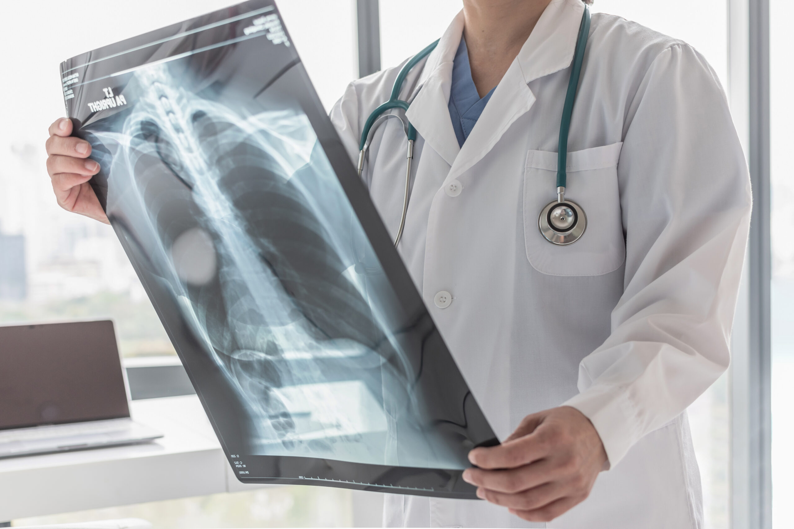 What Kinds Of Accidents Can Cause Herniated Discs At C4/C5 Or C5/C6?